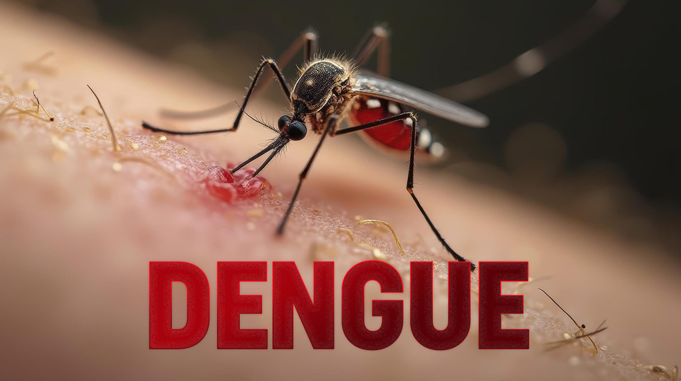 Ayurveda Management for Dengue Fever