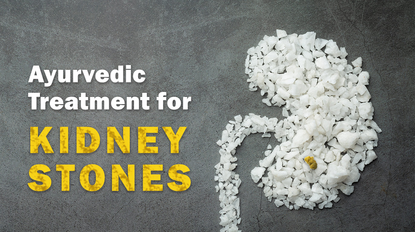 Ayurvedic Treatment for Kidney Stones